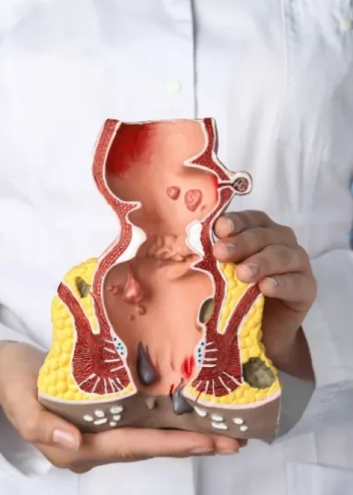 fissura-anal.jpg